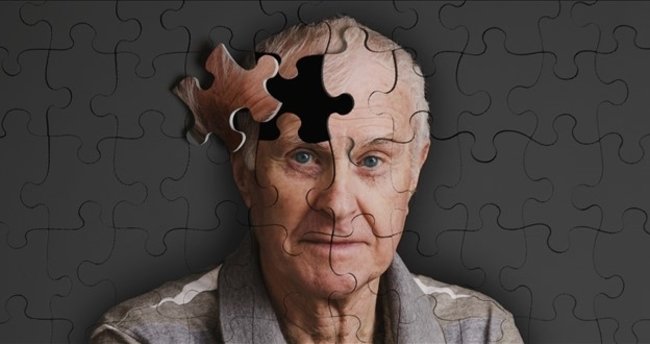 Alzheimer Nedir