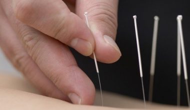 Hangi hastalıklar Akupunktur yöntemi ile tedavi edilebilir?