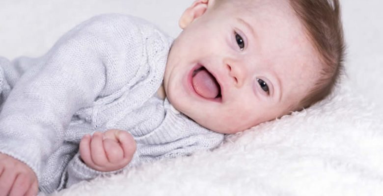 Down Sendromlu Bebeklerin Ortak Özellikleri Nelerdir?