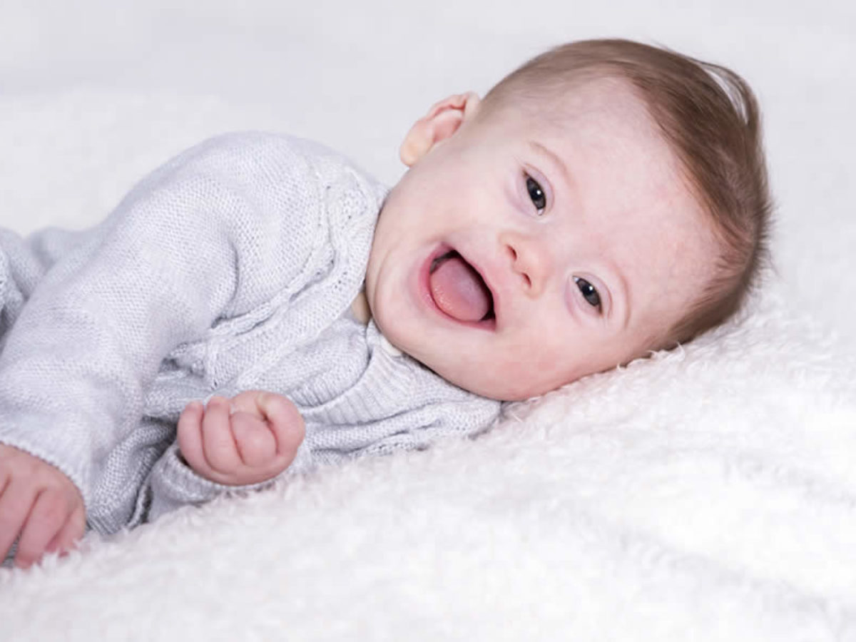 Down Sendromlu Bebeklerin Ortak Özellikleri Nelerdir?