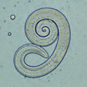Tricinella Spiralis